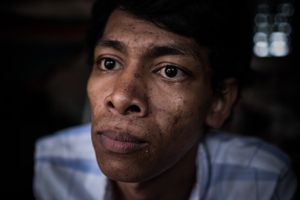 Into The Dark: Scenes From South East Asia's Meth Epidemic. An addict in his home in a slum,  Phnom Penh, Cambodia.