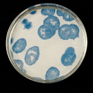 Gonorrhea Four