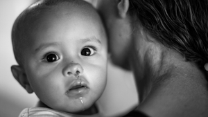 Operation Smile