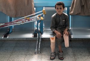 Yemen, Child Amputee
