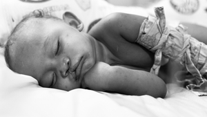 Operation Smile
