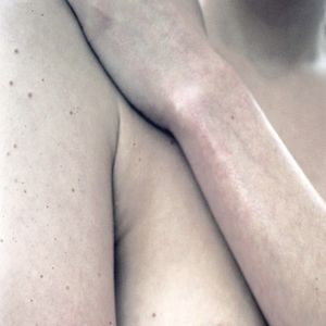 Untitled III (Skin Studies series)