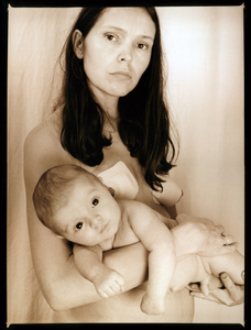 Mastitis