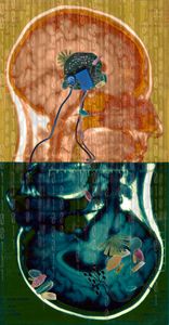 Amalgamated Fragmentation / Plastisphere–Body 1