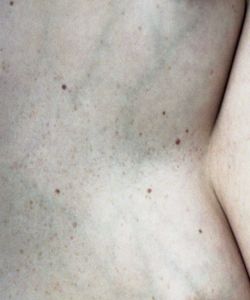 Untitled IV (Skin Studies series)