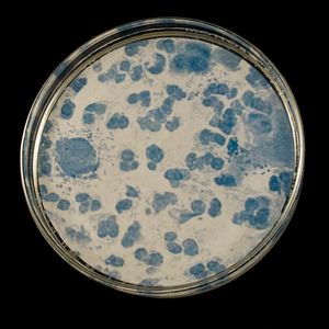 Trichomoniasis Two