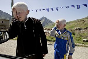 Two albino brothers begging near the Irani border city of Haj Omaran. © Tom Verbruggen