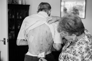 As the disease makes him more frail my father is prone to losing balance and falling over. This has resulted in a number of injuries. Wincing as my mother changes a dressing on his back after losing balance and sliding to the floor with his back to one of the walls which was covered in rough plaster.