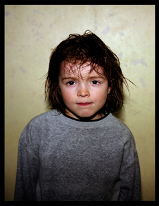 Rotavirus