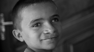 Operation Smile