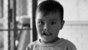 Operation Smile