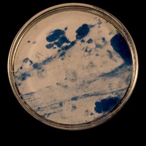 Gonorrhea Three