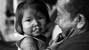 Operation Smile