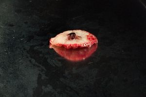 Basal cell carcinoma
