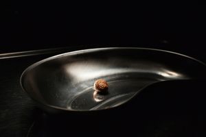 Gallstone#1