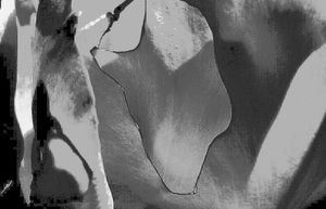 Metamorphosis 71