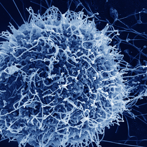 Ebola virus