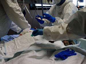 Extubation