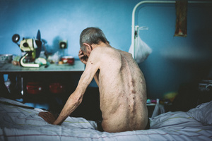 Mikhail, 1948. Diagnosis: MDR TB. Kherson TB hospital, July 2011.