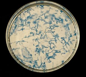 Syphilis Three