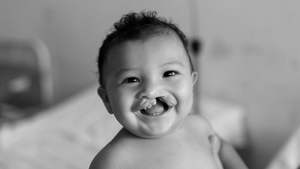 Operation Smile