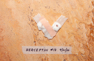 Herceptin  #17
