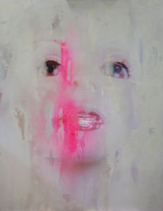 Surfaces I, H