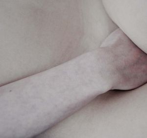 Casing I (Skin Studies series) diptych