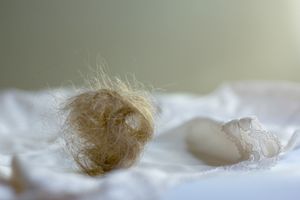Postpartum hairloss © Joy Christiansen Erb