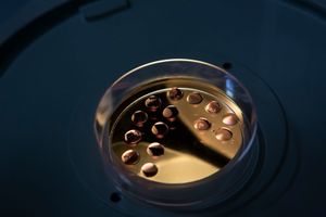 Ovules that have just arrived in the Bioembryo laboratory in Cuiaba. Each drop belongs to one cow and the tiny white dots in the drops are the ovules, visible to the naked eye. Cuiaba, Mato Grosso, Brazil, 2017