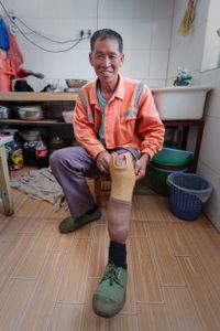 Li had an accident at the age of two, which caused osteomyelitis and, eventually, the loss of his left leg. His artificial limb allows him to lead an active life and he can still ride his motorcycle.
