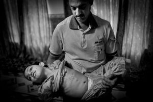 © Christian Werner - Iraq, Fallujah, Al-Jolan area, 18 April 2012 – Yasir Ali Aftan holds his sick, 10-year old daughter Mariam in his arms. After the war in 2003 she swallowed dust from the road, a short time later her stomach began to rot. In the hospital it was removed completely. Furthermore, the girl suffers from neurological damage.