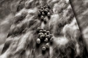 Skin of Soy