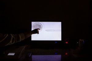 In the Geneal laboratory, the biotechnology technique points on the screen the process of elimination of the genetic material of the oocyte before it is transformed into a sexual cell to receive the cloned genetic material. Uberaba, Minas Gerais, Brazil, 2017