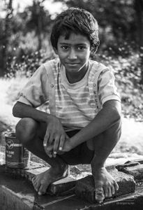 A young boy with stubbed toe | Dhanda, Punjab.