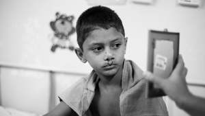 Operation Smile