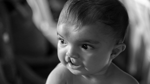 Operation Smile