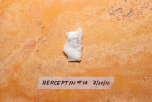 Herceptin #14